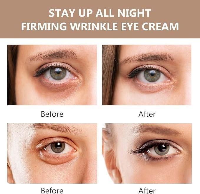 Instant Firmx Eye Bag Cream (Pack of 2) || VIBZU